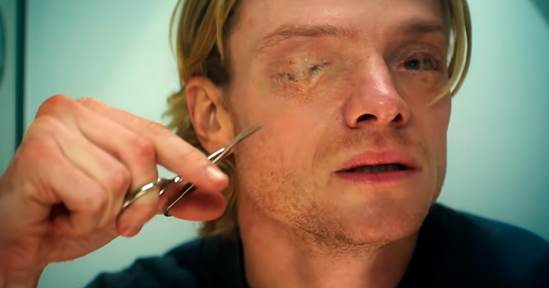 Tom Rhys Harries tem rosto desfigurado no trailer final de 'Cara-de-Barro'; assista